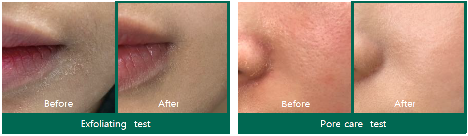 SOME BY MI AHA, BHA, PHA 30 Days Miracle Toner